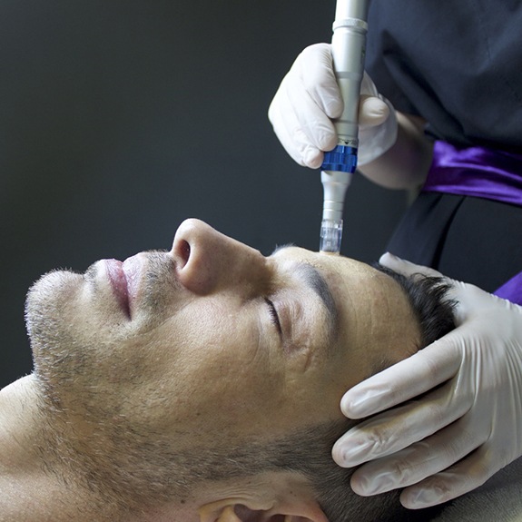 Relaxed, handsome man undergoing microneedling treatment in medspa
