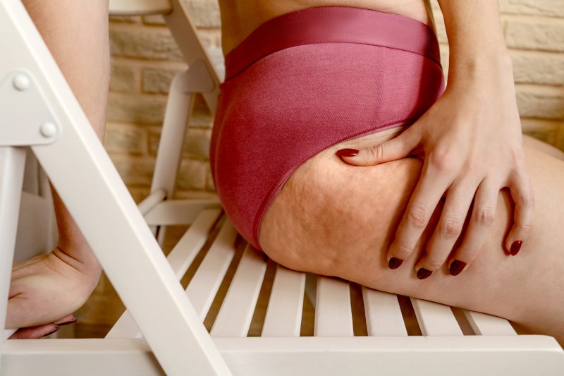 patient with cellulite 